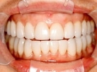 Konig Center for Cosmetic & Comprehensive Dentistry smile photos